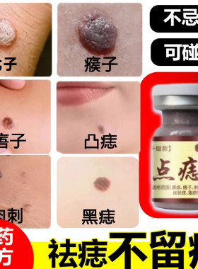 点痣痦子膏去脖子小肉粒抑菌液
