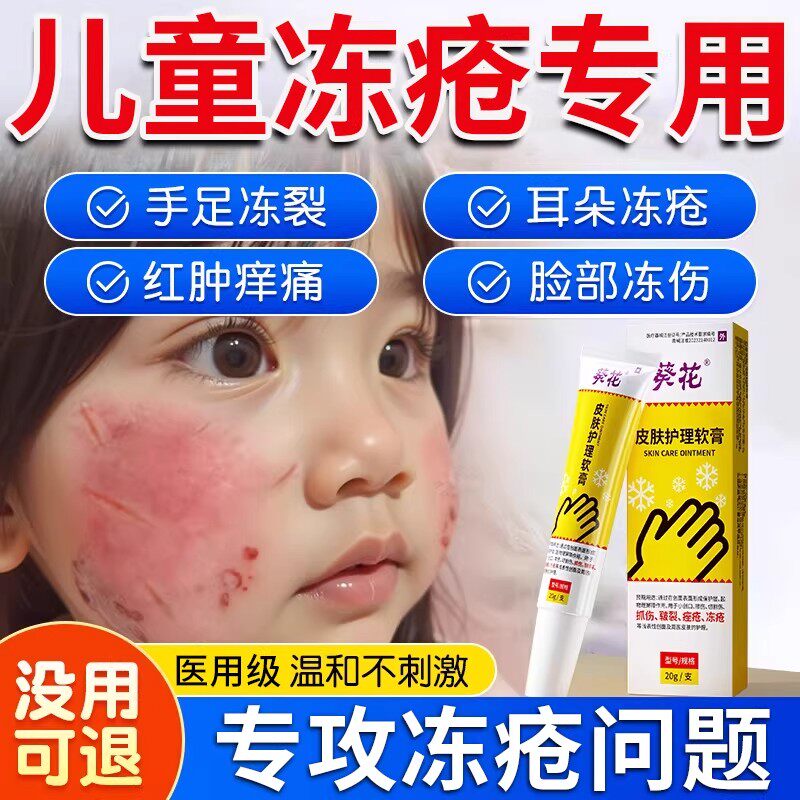 冻疮膏儿童止痒冻伤专用药膏防重度手脚耳朵脸部防冻裂特成人效