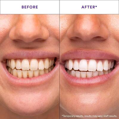 V34 Whitening Strips 牙贴 牙齿清洁护理牙贴片温和清洁日常