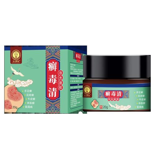 鹅掌风特效药手癣膏手足癣手气手足藓药手藓膏脱皮干裂真菌感染