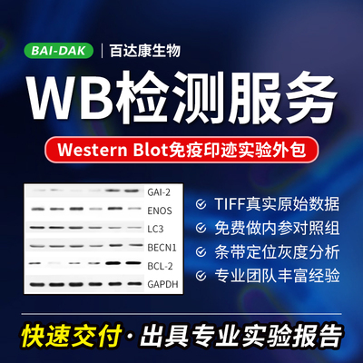 WB检测服务/Western blot免疫印迹实验外包/WB切膜整膜/趋势代做