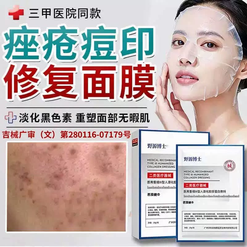 祛脸痤疮痘痘印淡黑补水面用膜