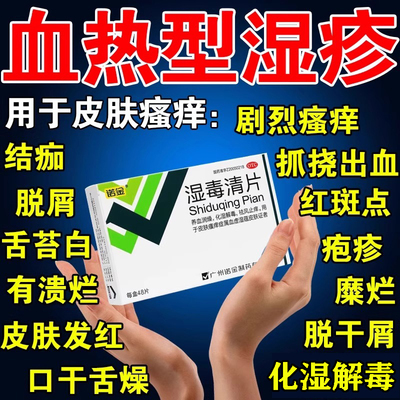 【诺金】湿毒清片0.6g*48片/盒