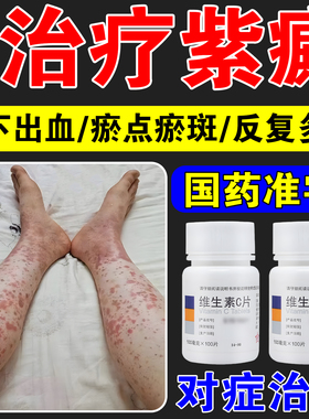 维生素c片辅助治疗紫癜皮下出血黏膜红紫色瘀斑过敏性皮肤病口服
