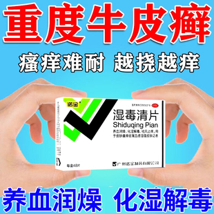 牛皮癣银屑病皮肤瘙痒干燥红斑养血润燥化湿毒祛风止痒湿热毒清片