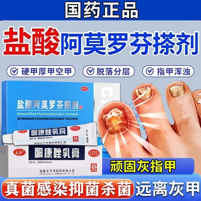 洛夫盐酸阿莫罗芬搽剂酮康唑乳膏灰指甲专用药治疗甲癣真菌感染SH