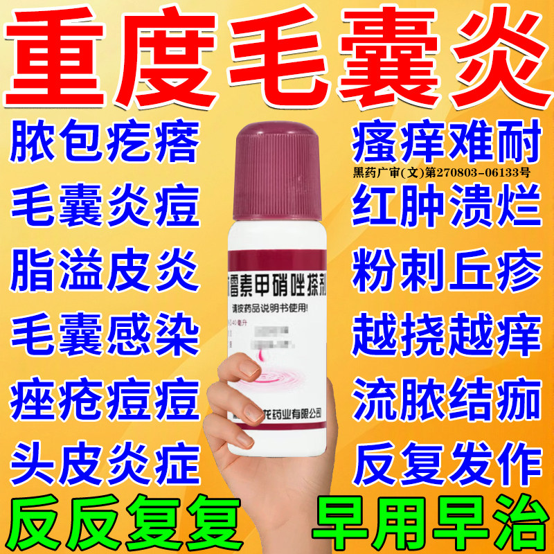 【天龙】克林霉素甲硝唑搽剂0.8%1%*40ml*1瓶/盒