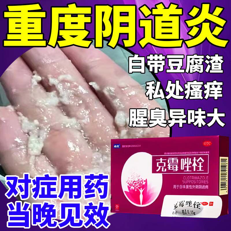 【中大】克霉唑栓0.15g*10粒/盒