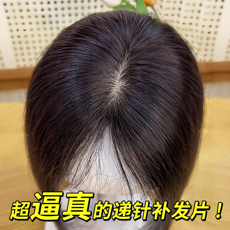假发女片头顶补发增发量蓬松w全真人发遮白发轻薄款自然刘海假发