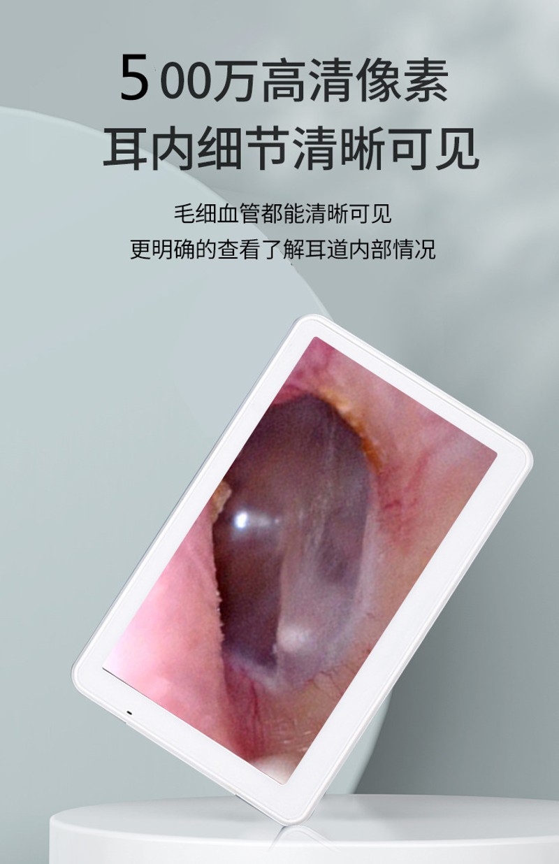 可视挖耳勺高清内窥镜q检耳镜耳朵清洁器扣耳勺仪器采耳工具掏耳