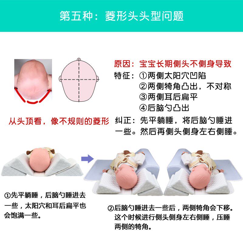 婴儿定型枕宝宝纠正头p型枕新生儿侧睡枕防偏头尖头扁平头舟状菱