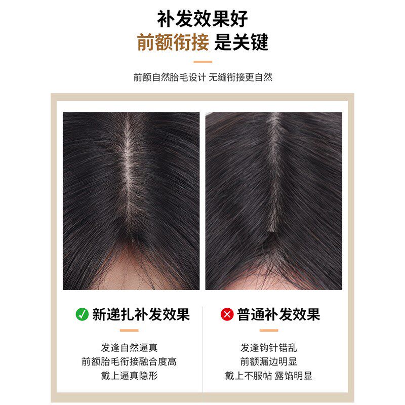 补发块头顶增发发片随意分缝全真发双递针刘海发片女士许昌假发片