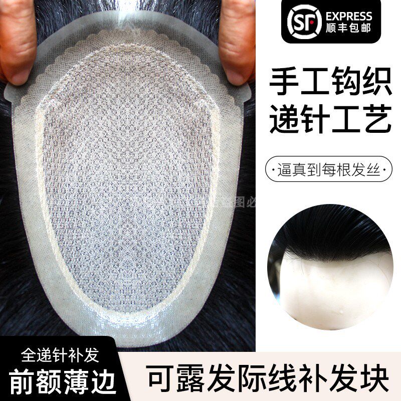 假发男士头顶前额全头套生物头皮全递针真发发际线假发贴隐形定制