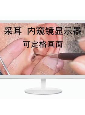 171222寸液晶显示9器白色工高清采耳BAI设备可定格业设备监视4器