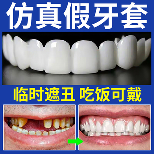牙套通用吃饭神器成人非防磨牙夜间大人专通用缺蛀牙临时遮丑假牙