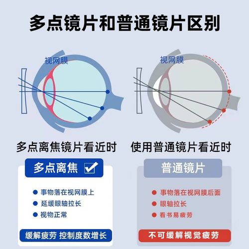 儿童多点离焦防控近视眼镜青少年延缓近视度数长防蓝光离焦镜片