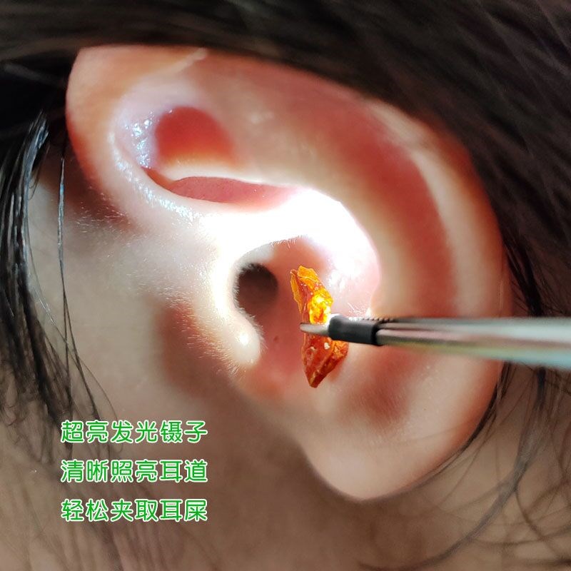 儿童发光镊子掏耳朵屎神器挖耳勺可视耵聍钩耳铲充V电专业采耳工