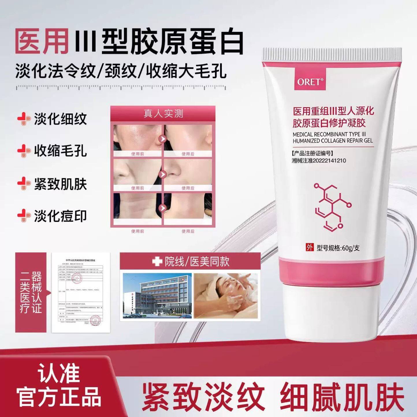 oret护理膜oret医用重组人源化胶原蛋白修护凝胶正品官方旗舰店