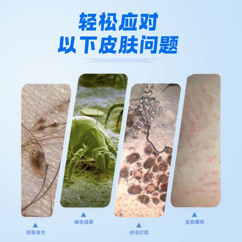 林旦乳膏阴虱正品官方抑菌硫磺乳软膏私处止痒男女洗剂950192