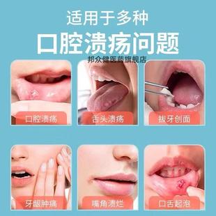 康瑞保重组人干扰素a2b喷雾剂成人儿童咽喉手足口腔干扰素喷剂213