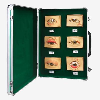 眼常见病模型A17110