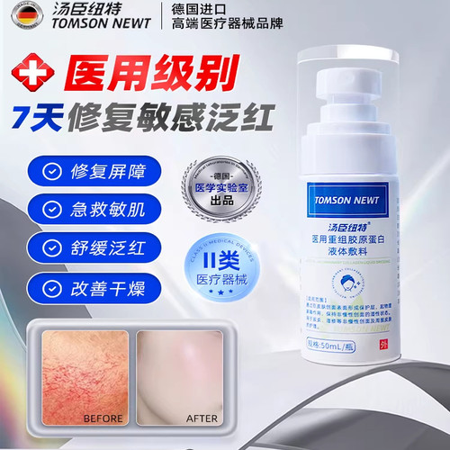 医用去红血丝喷雾修复屏障角质层受损增厚脸部泛红改善敏感肌肤mi