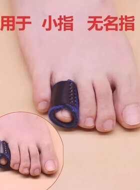 脚趾弯曲矫正器成人儿童爪状锤状