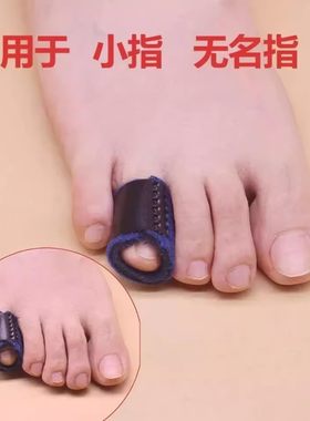 脚趾弯曲矫正器成人儿童爪状锤状