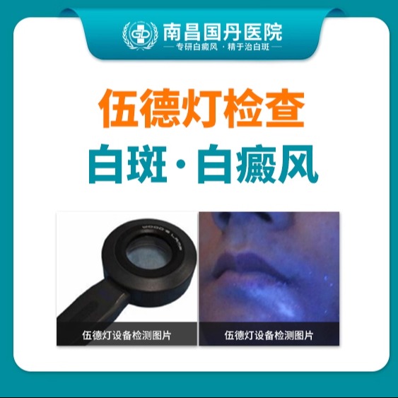 【热门产品】伍德灯仪器检查-白斑/白癜风