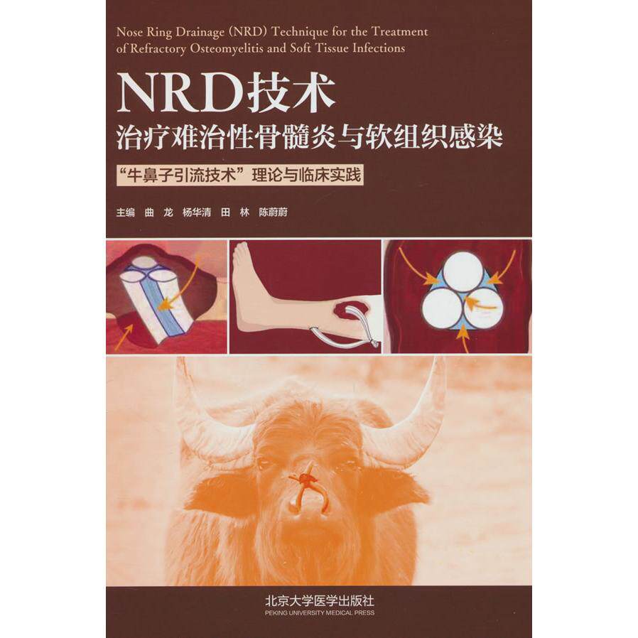 【新华正版】 NRD技术治疗难治性骨髓炎与软组织感染 北京大学医学出版社有限公司 曲龙