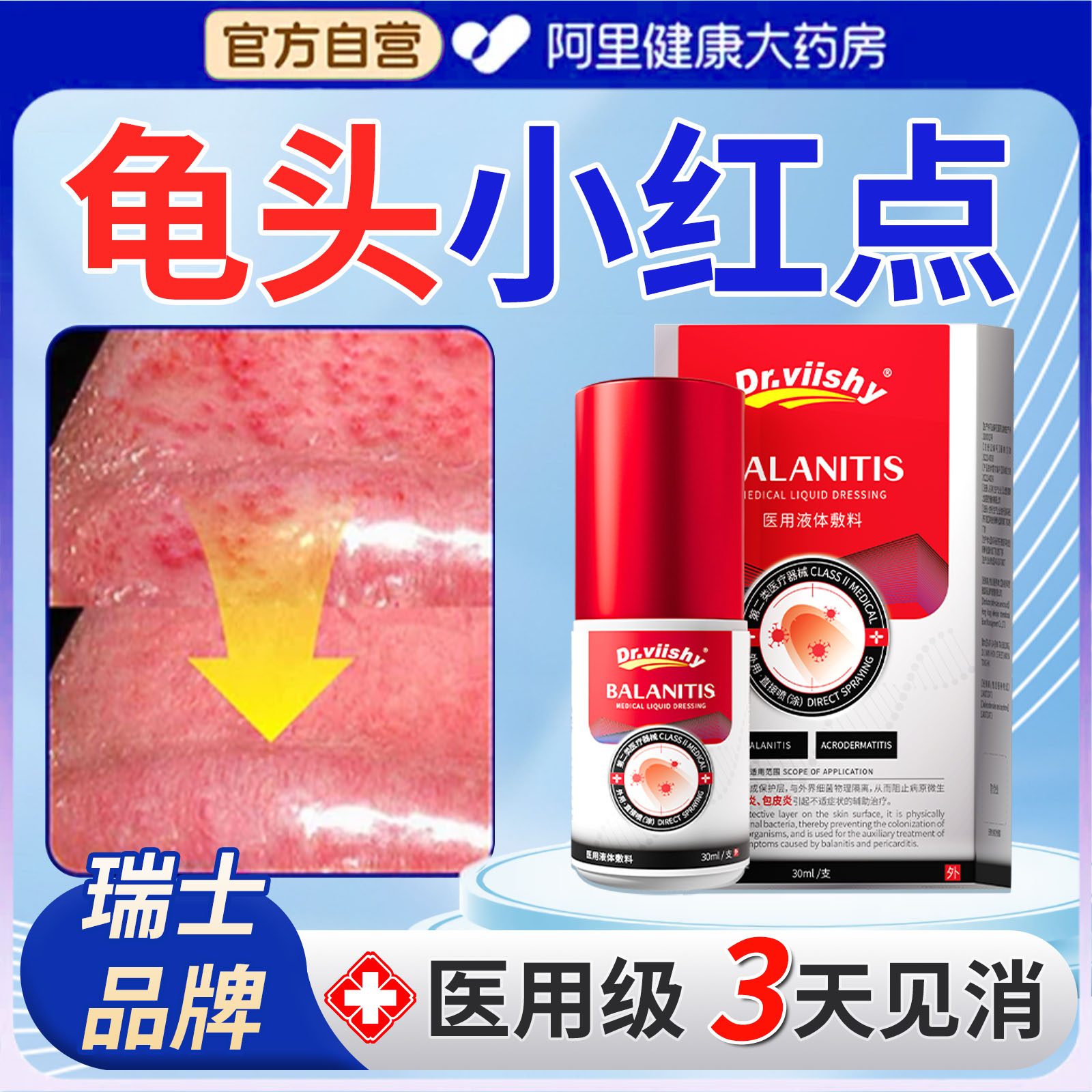 【热销T01】专治龟头红点包皮炎