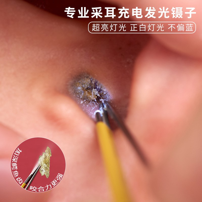 光纤发光镊子采耳工具儿童掏耳勺高级可视耵聍钩耳屎发光镊子