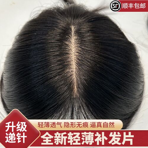 头顶真递针补发h片透气轻薄中分刘海少女辫子发假发片增发量遮白