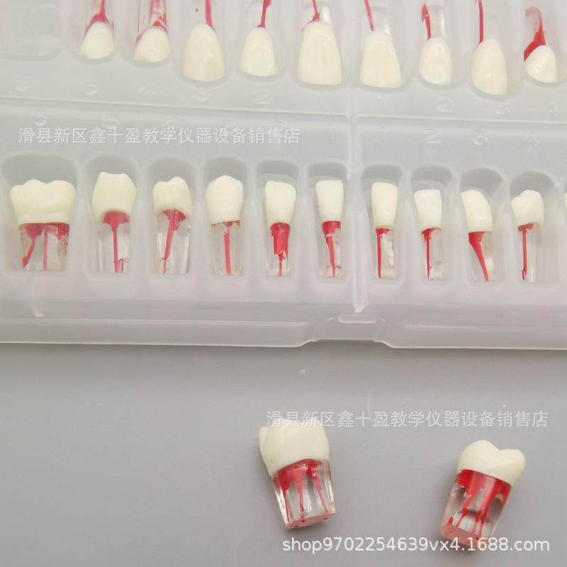 8全口破2颗根管牙32275模型牙科学生练习髓冠根充开扩大疏通离体,文具电教/文化用品/商务用品,教学标本/模型,淘宝优惠券,粉丝福利购,淘宝优惠卷