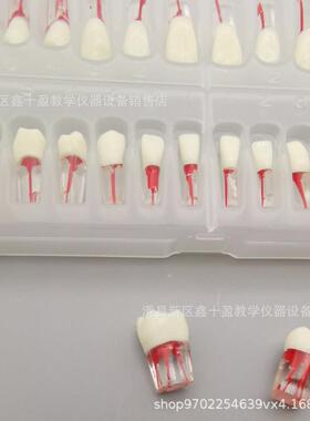 8全口破2颗根管牙32275模型牙科学生练习髓冠根充开扩大疏通离体
