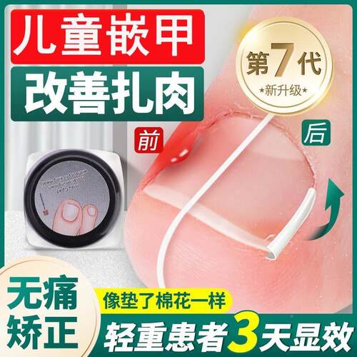 儿童甲沟嵌甲矫正器炎正甲贴脚趾甲贴片指甲长肉里专X用填充隔离