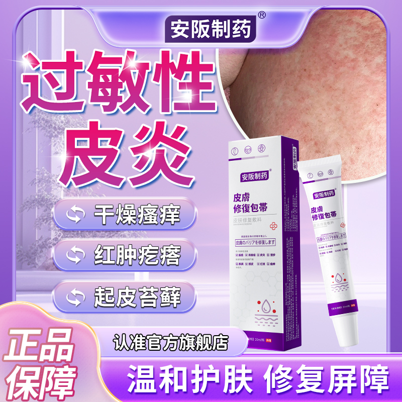 过敏性皮炎寻荨麻疹止痒药膏修复皮肤干燥瘙痒乳软膏皮炎敷料SJ