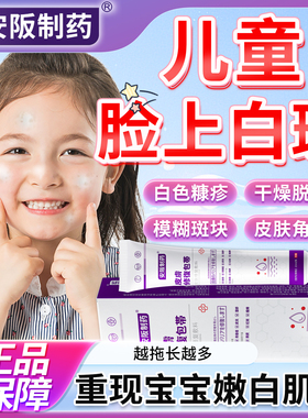 白色糠疹药膏儿童脸上长白斑小孩汗斑花斑桃花癣干燥脱皮用药膏SJ