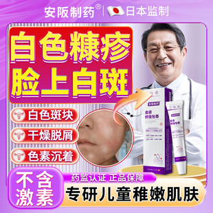 白色糠疹药膏儿童脸上长白斑小孩子汗斑花斑桃花癣干燥脱皮瘙痒KY
