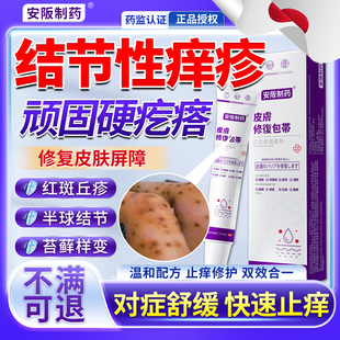 结节性痒疹皮肤湿疹治顽固硬疙瘩丘疹特瘙痒止痒效顽固皮炎药膏KY