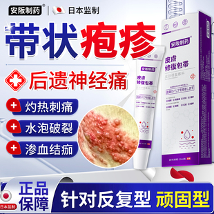 带状疱疹后遗症神经痛特灼热刺痛水泡破裂效修复治疗蛇盘疮药KY