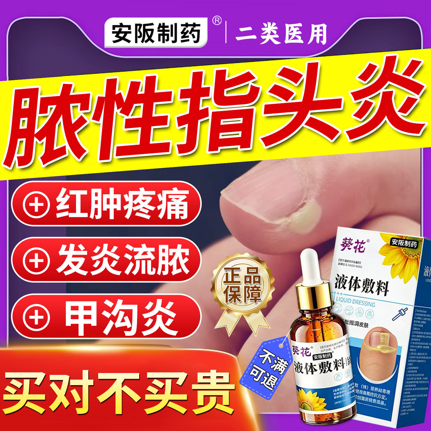 脓性指头炎手指甲真菌感染红肿疼溃烂专甲沟炎用手指化脓炎消肿药