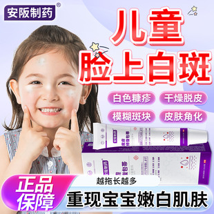 白色糠疹药膏儿童脸上长白斑小孩汗斑花斑桃花癣干燥脱皮用药膏SJ