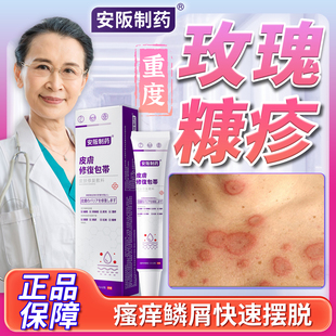 玫瑰糠疹专汗斑花斑铜钱癣体癣红斑鳞屑皮炎湿疹屏障修复用药膏SJ