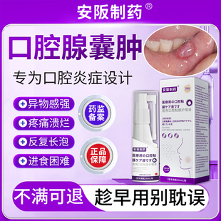 口腔粘液腺囊肿唾液腺舌下腺疙瘩水泡异物感强溃烂疼痛进食困难KY