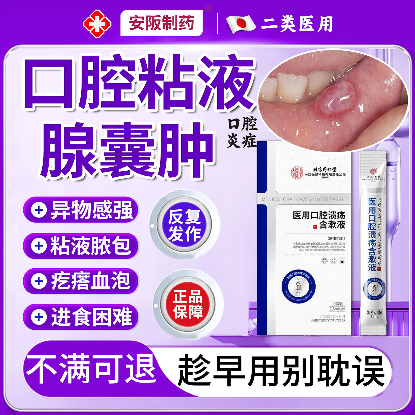 口腔粘液腺囊肿唾液腺舌下腺疙瘩水泡异物感强溃烂疼痛进食困难KY