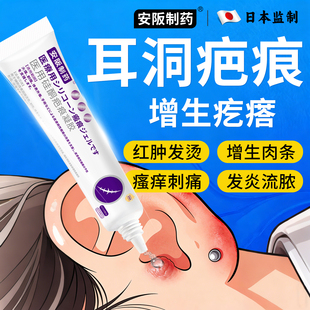 耳洞疤痕增生凸起去除疙瘩贴硬肉软化针可搭膏药止痒软化痒乳膏KY