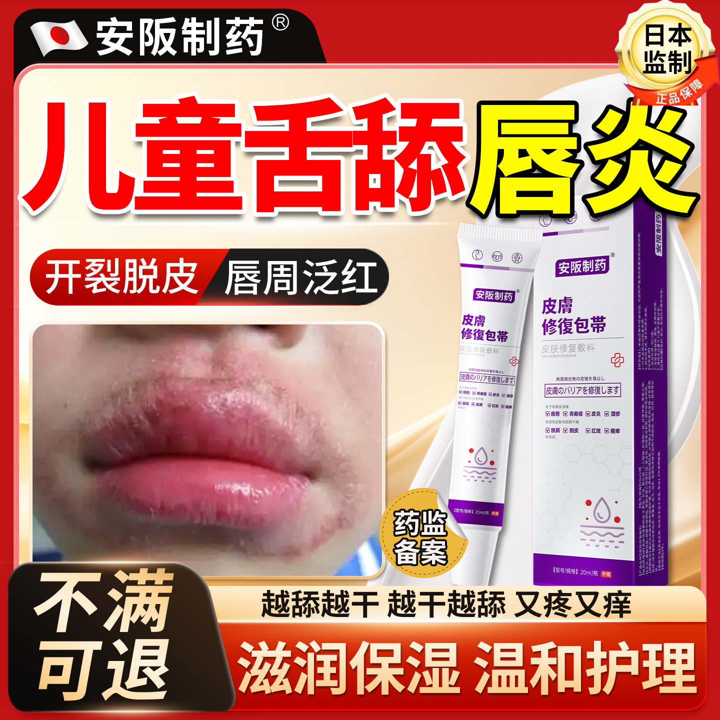 舔唇炎唇膏嘴唇干裂脱皮医用凝胶