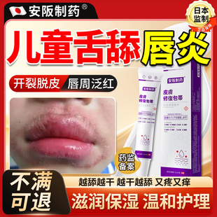 儿童舌舔唇炎唇膏嘴唇干裂脱皮医用型嘴巴一圈红口周皮炎药膏KY