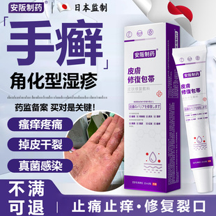 角化型湿疹手指部瘙痒脱皮干燥手癣可搭干裂贴掉皮真菌感染药膏KY